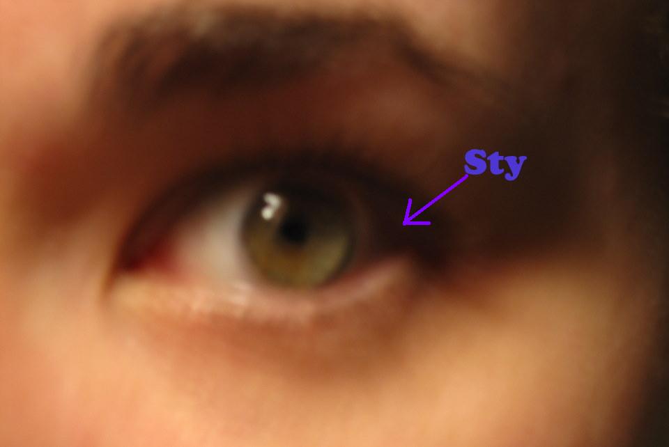 Sty Images