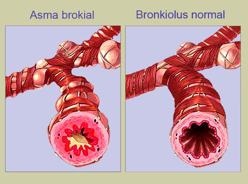 Tus Pulmones en este Megapost