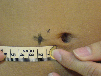 Abdominal Skinfold