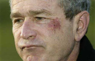 Bush after “choking on a pretzel”