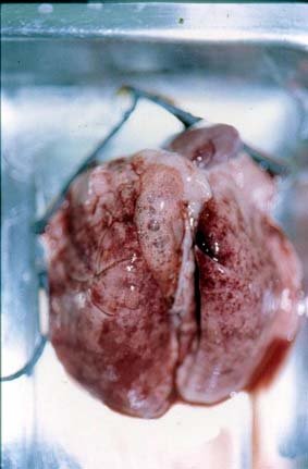 [اصابة+الرئتين.bmp]