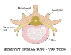 Spinal Disc Picture