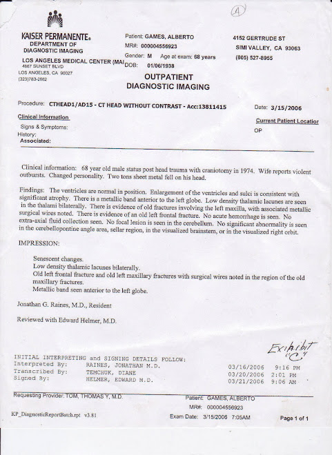 Ct+scan+brain+without+contrast