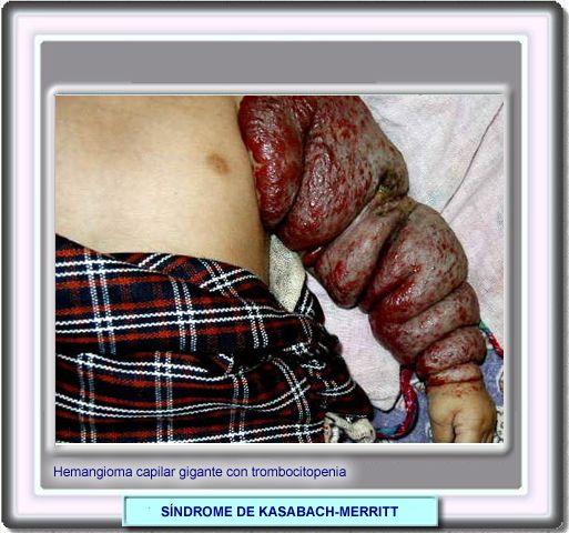 [kasabach01.jpg]