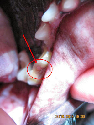 Tooth Broke