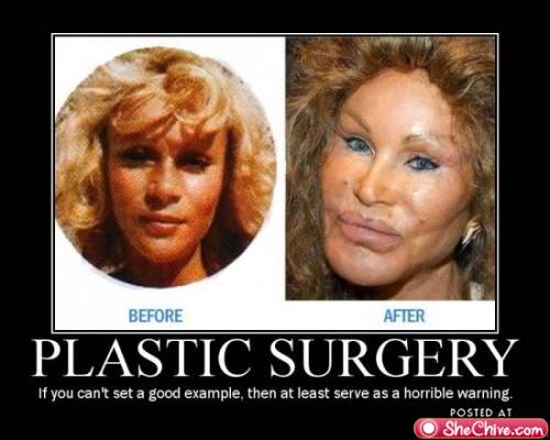 Plastic Surgery Gone Bad. Plastic Surgery
