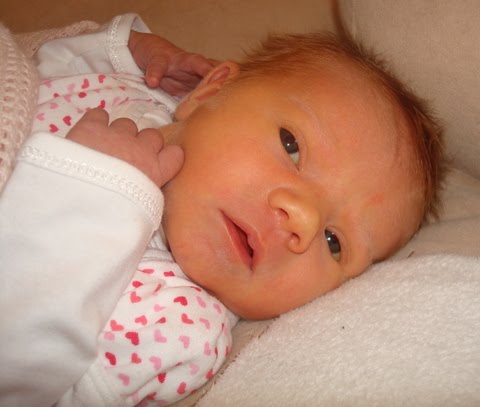 Birthmark In Eye