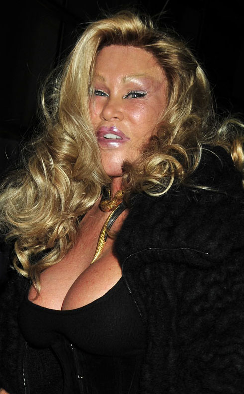 Jocelyn Wildenstein Wiki. ask