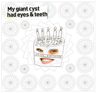 Giant Cyst
