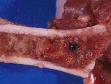 Aplasia medular (linfoma, porcino)