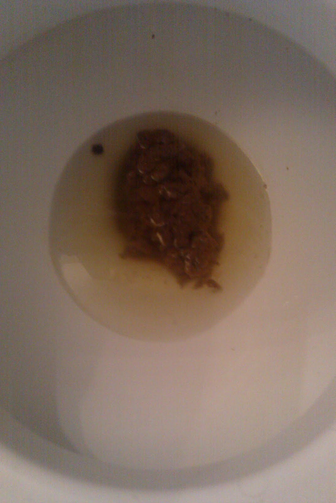 Bristol Chart Kohler K4512 Toilet