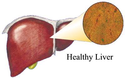 Advanced Liver Cancer Symptoms 