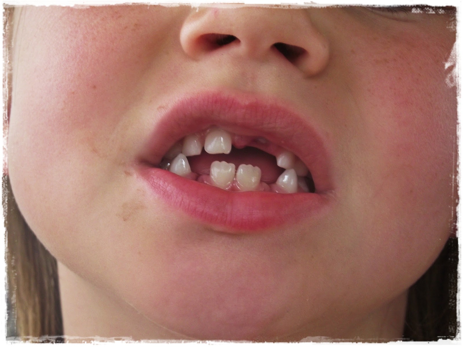 Great Fun etc Wordless Wednesday GapToothed Glory