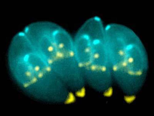 [toxoplasma_gondii.jpg]