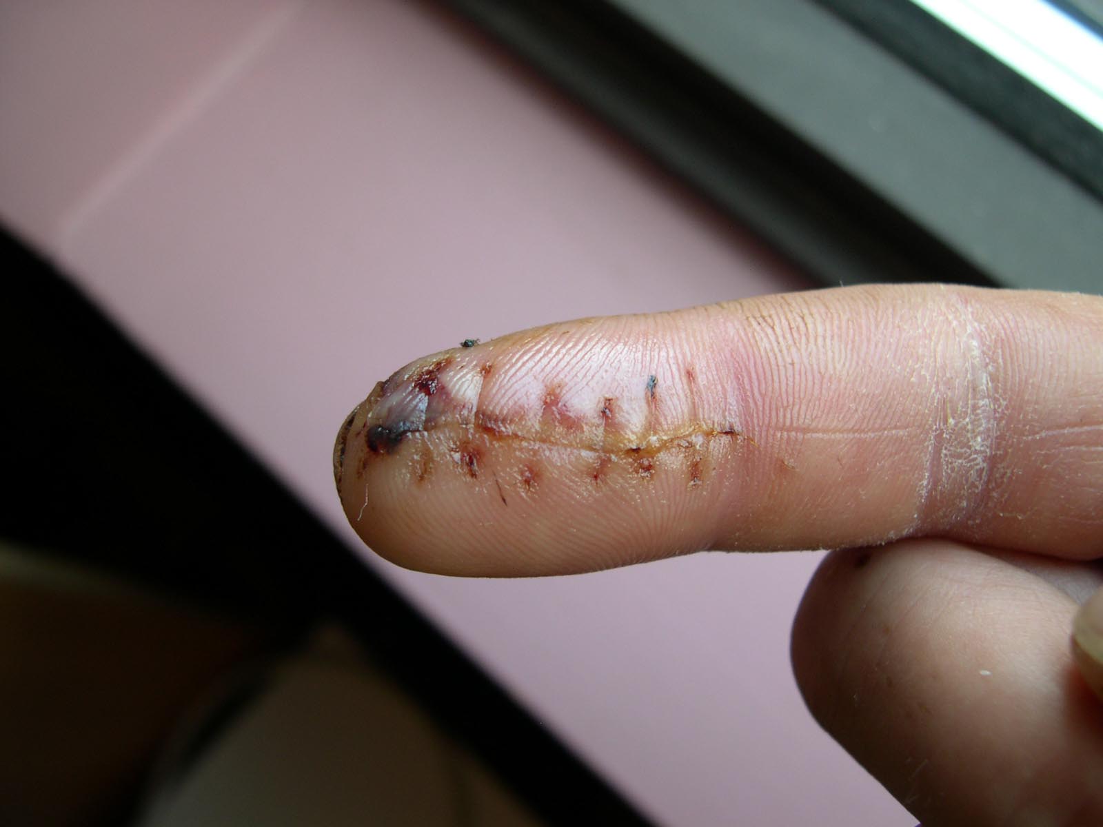 finger i skeden erotiske sites finger i skeden erotiske sites