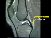 lcp+integro.001.jpg