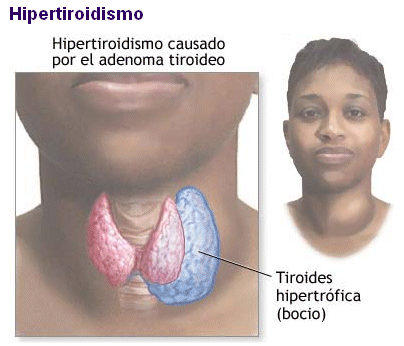 El ungüento de la eccema y el picor las revocaciones