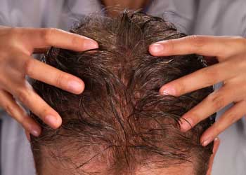 La máscara de la caída de los cabello de la cebolla y el pimiento