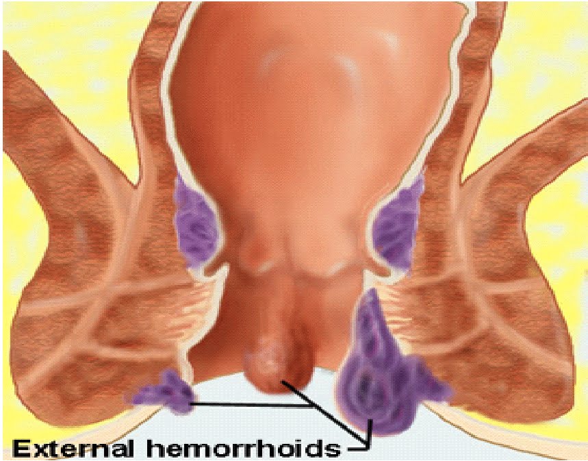 Can Dogs Get Hemorrhoids Symptoms Can Dogs Get Hemorrhoids Symptoms