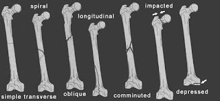 RadiologySpirit: Long Bone Review