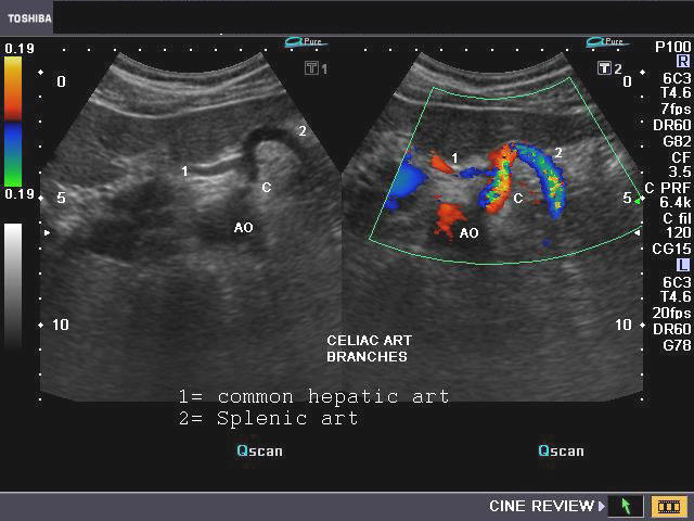 RadiologySpirit