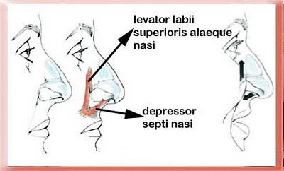 drooping nasal tip