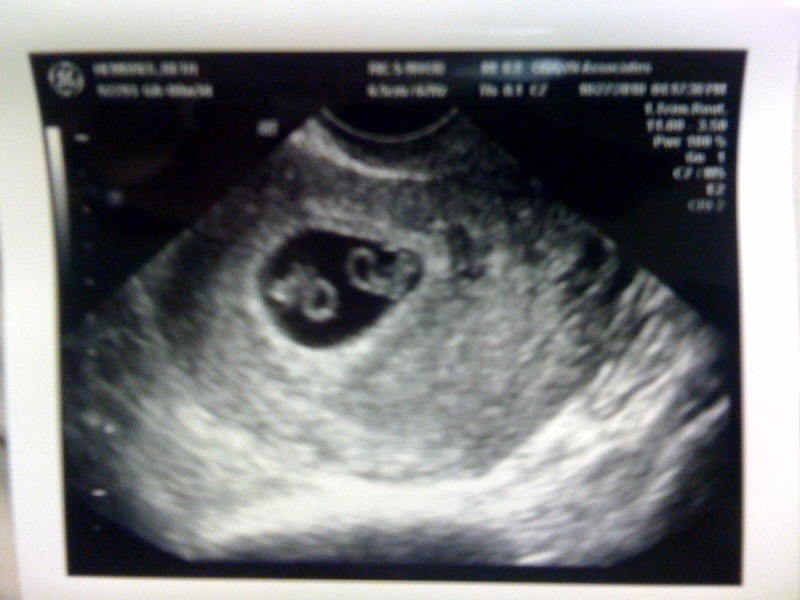 Beth Allison�s Wonderland January 2011