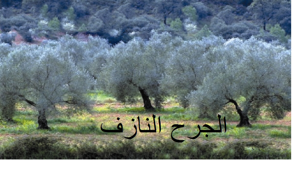 الجرح النازف