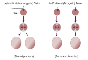 science form 4 identical vs non identical twins how to twins form