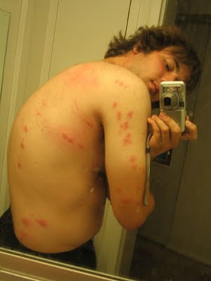 worse than to spider bites spider bites on dogs. worse than to spider bites