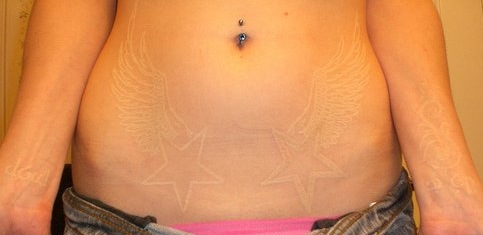White Tattoos on Bubble Pop Electric White Ink Tattoos