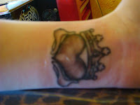 All done... Pretty sore, pretty red and pretty swollen!