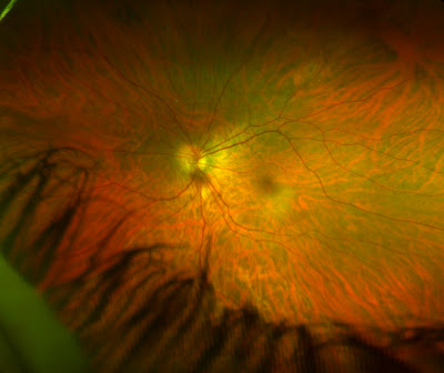 Retinal eye scan image