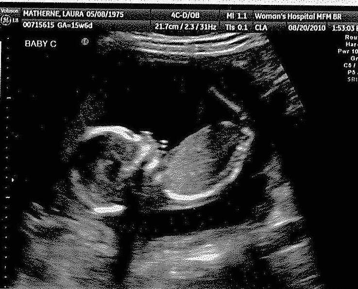 The Matherne Quads! 16 week ultrasound Baby C Its a Girl!