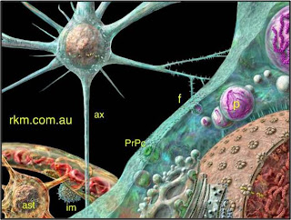 44+ Creutzfeldt-Jakob Disease (Cjd) Kuru Scrapie And Mad Cow Disease Are Caused By Pics