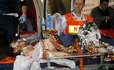 Doctor's daughter seriously wounded