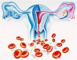 heavy period causes