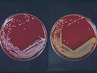 estafilococos sangre staphylococcus aureus epidermidis colonias bacterias paraiso placas bacteria