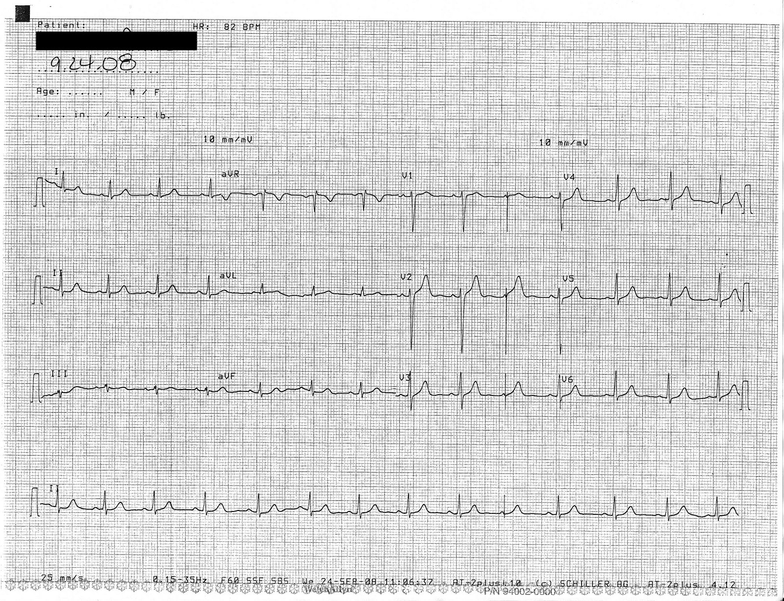 [ekg.jpg]