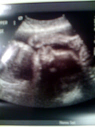 Baby B (arm and fist raised above head)