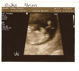 Irwin with an "I": 10 Week Ultrasound