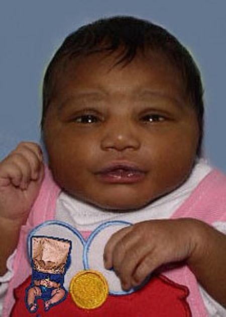 ugly babies pictures. Most quot;Uglyquot; Babies Photos