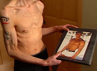 Ashley's Skinny Blog: Ex-Model Jeremy Gillitzer