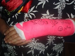 [cast]