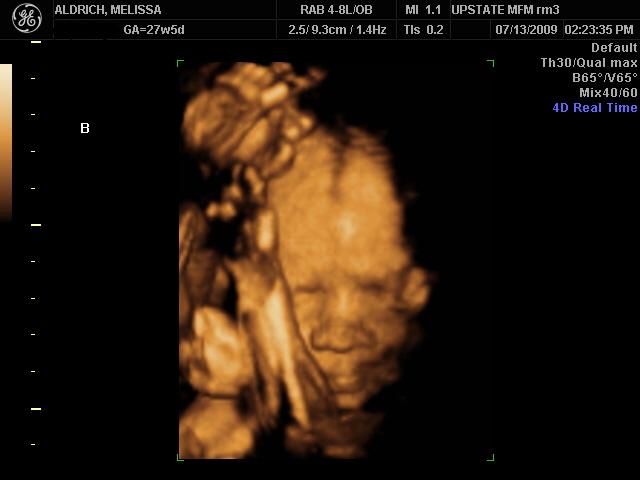 [BABIES+7-13-09_18.JPG]