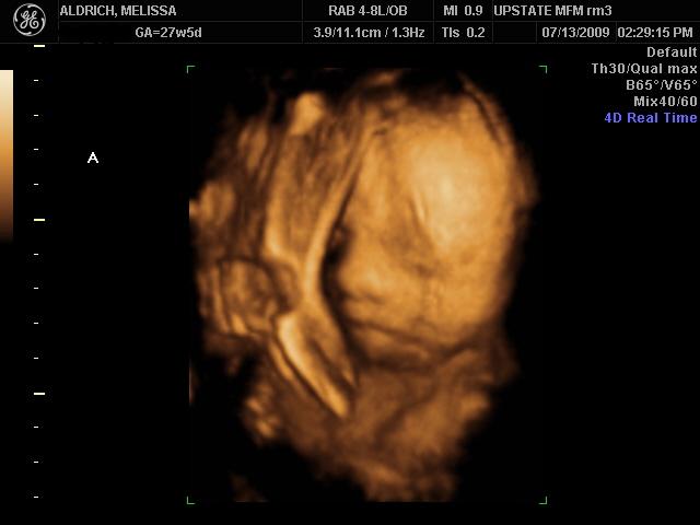 [BABIES+7-13-09_26.JPG]
