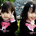 2 sebab terjadinya bayi kembar