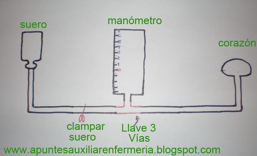 Presión Venosa Central.(PVC) APUNTES AUXILIAR ENFERMERIA