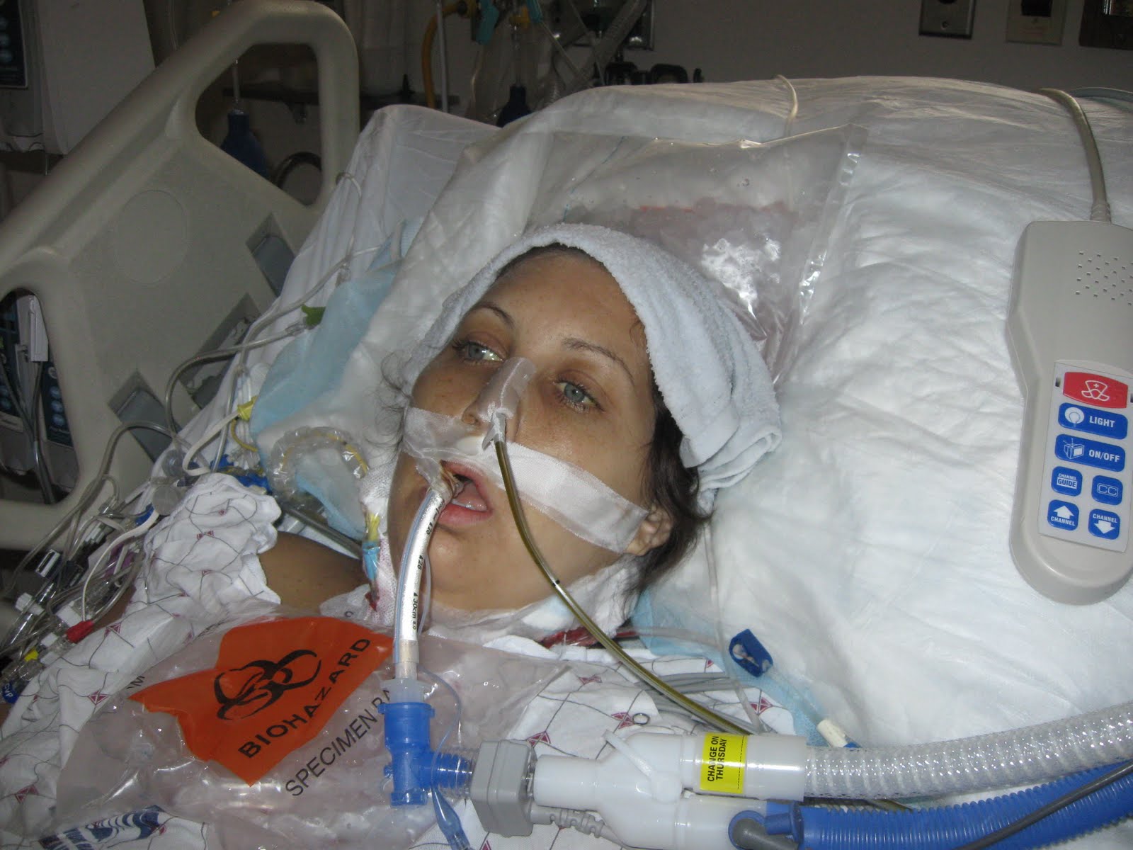 Robbi's Story*. PICTURES, and Monday September 20, 2010 update