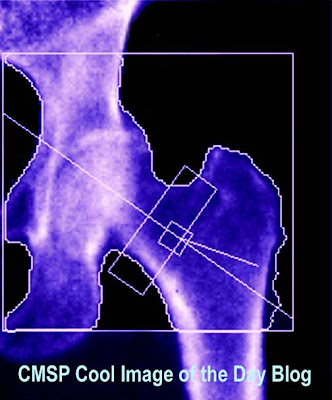 Dexa Scans